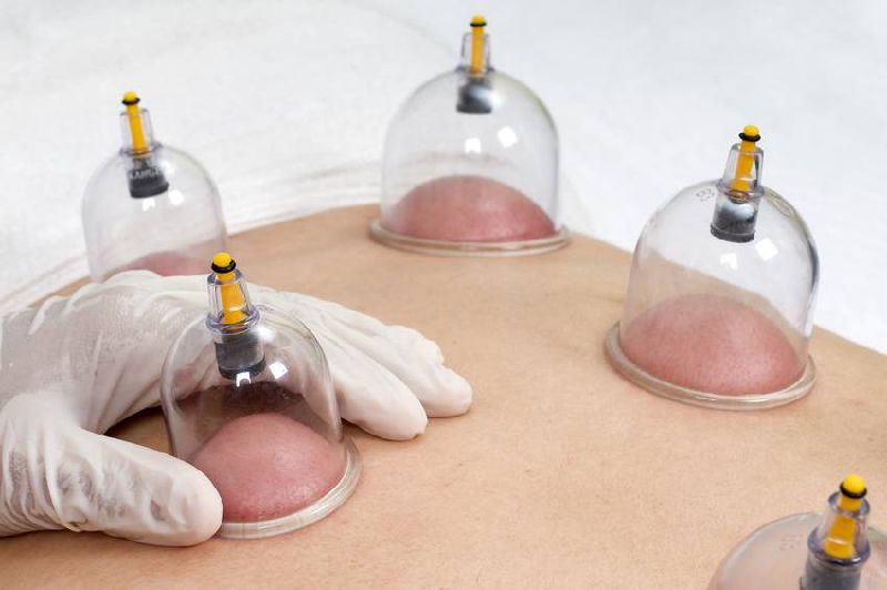 Discover Hijama